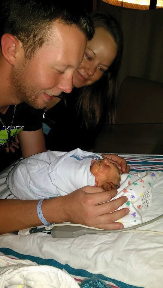 baby with no skull jaxon buell