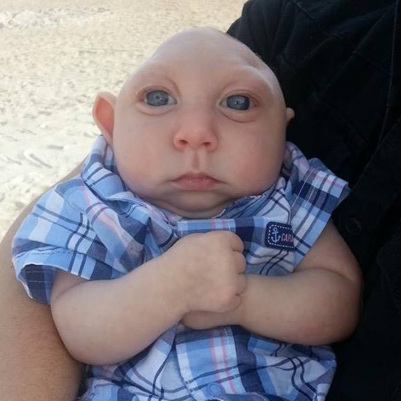 baby with no skull jaxon buell
